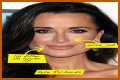 Botox, Implants & More! – Hollywood Life